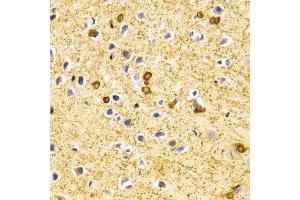 Immunohistochemistry of paraffin-embedded Rat brain using BIN1 antibody at dilution of 1:100 (x400 lens). (BIN1 抗体  (AA 230-409))