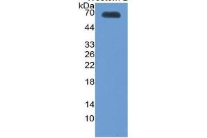 WB of Protein Standard: different control antibodies  against Highly purified E. (Thrombopoietin ELISA 试剂盒)