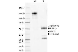 SDS-PAGE Analysis Purified Wilm's Tumor Mouse Monoclonal Antibody (6F-H2). (WT1 抗体  (AA 1-181))