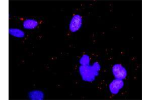 Proximity Ligation Assay (PLA) image for anti-Eukaryotic Translation Initiation Factor 4E Binding Protein 1 (EIF4EBP1) (AA 1-118) antibody (ABIN560717)