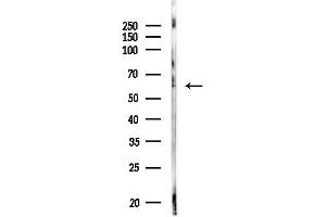 Western blot analysis of lysates from MDA-MB-231 cells, using HNF1 beta Antibody at 1/1000 dilution.