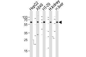 Western blot analysis of lysates from HepG2, A549, HT-29 cell line, human kidney and liver tissue lysate (from left to right), using CYP3A4 Antibody at 1:1000 at each lane. (CYP3A4 抗体  (AA 228-255))