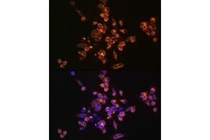 Immunofluorescence analysis of HeLa cells using [KO Validated] Annexin /Annexin V Rabbit pAb (ABIN3022450, ABIN3022451, ABIN3022452 and ABIN1512578) at dilution of 1:100 (40x lens). (Annexin V 抗体  (AA 1-320))