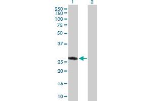 Western Blot analysis of ASB9 expression in transfected 293T cell line by ASB9 MaxPab polyclonal antibody. (ASB9 抗体  (AA 1-294))