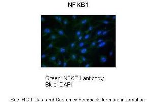 Sample Type :  Chicken DF-1 Firboblast  Primary Antibody Dilution :  1:100  Secondary Antibody :  Anti-rabbit FITC  Secondary Antibody Dilution :  1:300  Color/Signal Descriptions :  NFKB1: Green DAPI:Blue  Gene Name :  NFKB1   Submitted by :  Anonymous (NFKB1 抗体  (N-Term))