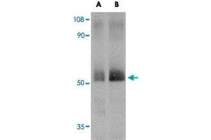 Western blot analysis of SPRED2 in human small intestine tissue lysate with SPRED2 polyclonal antibody  at (A) 1 and (B) 2 ug/mL . (SPRED2 抗体  (Internal Region))