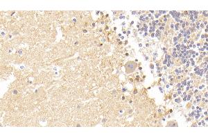 Immunohistochemistry (IHC) image for anti-Calcium Modulating Ligand (CAMLG) (AA 19-184) antibody (ABIN7444568)