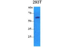 Western Blotting (WB) image for anti-Pyruvate Kinase, Liver and RBC (PKLR) antibody (ABIN781545) (PKLR 抗体)