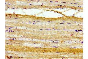 Immunohistochemistry of paraffin-embedded human skeletal muscle tissue using ABIN7142919 at dilution of 1:100 (AKIP1 抗体  (AA 57-167))