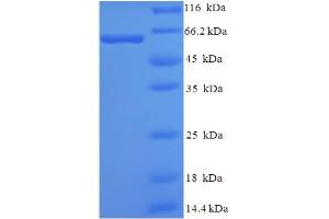 SDS-PAGE (SDS) image for SH3-Domain GRB2-Like Endophilin B2 (SH3GLB2) (AA 1-395), (full length) protein (His-SUMO Tag) (ABIN5711809)