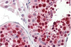 Immunohistochemistry (IHC) image for anti-ATP-Binding Cassette, Sub-Family A (ABC1), Member 9 (ABCA9) (Internal Region) antibody (ABIN263230)