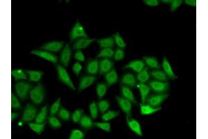Immunofluorescence analysis of A549 cell using IRF8 antibody. (IRF8 抗体)
