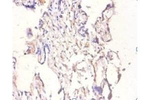 Immunohistochemistry of paraffin-embedded human placenta tissue using ABIN7145696 at dilution of 1:100 (BMP6 抗体  (AA 382-513))