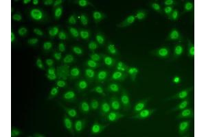Immunofluorescence analysis of HeLa cells using CRY2 antibody (ABIN6130206, ABIN6139068, ABIN6139070 and ABIN6217229). (CRY2 抗体  (AA 455-614))