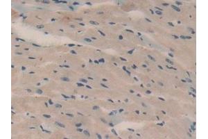 Immunohistochemistry (IHC) image for anti-Oncomodulin (OCM) (AA 1-109) antibody (ABIN7439579)