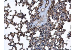 IHC-P Image FARSLA antibody [N2C2], Internal detects FARSLA protein at cytoplasm in mouse lung by immunohistochemical analysis. (Phenylalanyl-tRNA Synthetase, alpha Subunit (FARSA) 抗体)