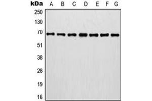 Western blot analysis of Involucrin expression in MCF7 (A), A375 (B), A431 (C), NIH3T3 (D), HT1080 (E), mouse brain (F), rat brain (G) whole cell lysates. (Involucrin 抗体  (C-Term))