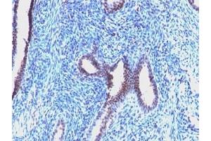 Immunohistochemistry (Formalin-fixed Paraffin-embedded Sections) (IHC (fp)) image for anti-Cyclin B1 (CCNB1) antibody (ABIN3025089)