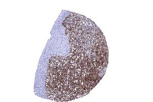 Strong decorin staining of the stroma while urothelium remains unstained in the urinary bladder (Recombinant Decorin 抗体  (AA 212-336))