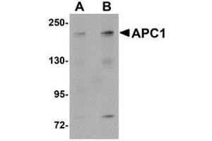 Western blot analysis of APC1 in SK-N-SH cell lysate with AP30057PU-N APC1 antibody at (A) 1 and (B) 2 μg/ml. (APC1 抗体  (C-Term))