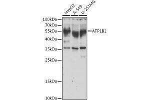 Western blot analysis of extracts of various cell lines, using B1 antibody (ABIN6127389, ABIN6137306, ABIN6137309 and ABIN6221475) at 1:1000 dilution. (ATP1B1 抗体  (AA 63-303))