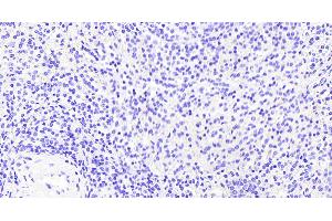(ABIN185278) Negative Control showing staining of paraffin embedded Human Spleen, with no primary antibody. (VAV3 抗体  (Internal Region))