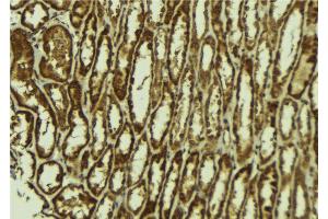ABIN6272547 at 1/100 staining Mouse kidney tissue by IHC-P. (MINA 抗体)