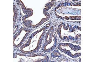 IHC analysis of Kindlin 2/FERMT2 using anti-Kindlin 2/FERMT2 antibody (ABIN7599515). (FERMT2 抗体  (AA 1-650))
