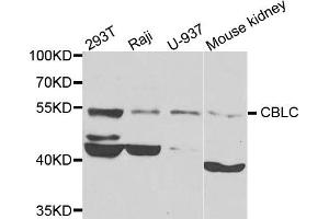 Western blot analysis of extracts of various cells, using CBLC antibody. (CBLC 抗体)