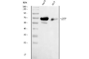 Western blot analysis of alpha 1 Fetoprotein/AFP using anti-alpha 1 Fetoprotein/AFP antibody (ABIN7600406).