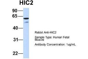 Host:  Rabbit  Target Name:  HIC2  Sample Type:  Human Fetal Muscle  Antibody Dilution:  1. (HIC2 抗体  (Middle Region))