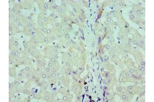 Immunohistochemistry of paraffin-embedded human liver tissue using ABIN7171193 at dilution of 1:100 (Syndecan 1 抗体  (AA 25-240))