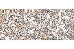 Immunohistochemistry of paraffin-embedded Human tonsil tissue using MRPS28 Polyclonal Antibody at dilution of 1:60(x200) (MRPS28 抗体)