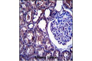 NPC1 Antibody (Center) (ABIN657395 and ABIN2846435) immunohistochemistry analysis in formalin fixed and paraffin embedded human kidney tissue followed by peroxidase conjugation of the secondary antibody and DAB staining. (NPC1 抗体  (AA 591-620))