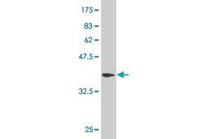 Western Blotting (WB) image for anti-Dihydropyrimidinase-Like 3 (DPYSL3) (AA 457-555) antibody (ABIN515067)
