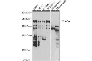 Western blot analysis of extracts of various cell lines, using THADA antibody (ABIN6133115, ABIN6149103, ABIN6149104 and ABIN6222943) at 1:1000 dilution. (THADA 抗体  (AA 1684-1953))
