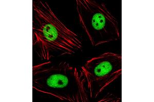 Immunofluorescent analysis of 4 % paraformaldehyde-fixed, 0. (EZH2 抗体  (N-Term))