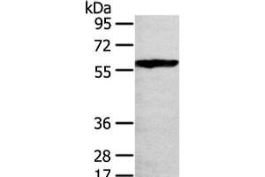 Western Blot analysis of 293T cell using THAP4 Polyclonal Antibody at dilution of 1/250 (THAP4 抗体)