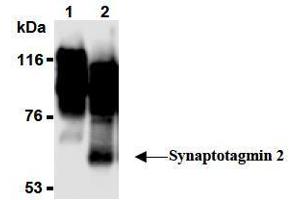 Western Blotting (WB) image for anti-Synaptotagmin II (SYT2) (AA 1-20), (N-Term) antibody (ABIN1449191) (SYT2 抗体  (N-Term))