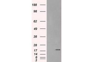 Image no. 2 for anti-Crystallin, alpha B (CRYAB) antibody (ABIN1497648) (CRYAB 抗体)