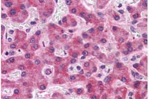 Human Liver: Formalin-Fixed, Paraffin-Embedded (FFPE) (SIPA1L2 抗体  (N-Term))
