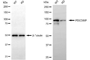 Western blotting analysis using PDCD6IP antibody (ABIN7799908). (Recombinant ALIX 抗体)