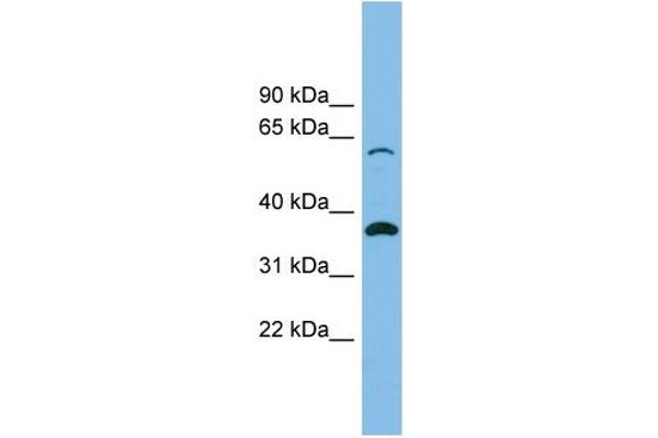 SLC25A4 anticorps  (N-Term)