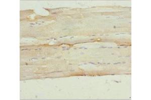 Immunohistochemistry of paraffin-embedded human skeletal muscle tissue using ABIN7161157 at dilution of 1:100 (NPHP3 抗体  (AA 1-130))