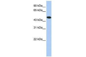 TXNDC5 antibody used at 1 ug/ml to detect target protein. (TXNDC5 抗体  (N-Term))