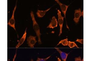 Immunofluorescence analysis of L929 cells using RPL36AL Polyclonal Antibody at dilution of 1:100 (40x lens). (RPL36AL 抗体)