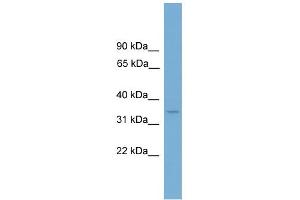 WB Suggested Anti-LUM Antibody Titration: 0. (LUM 抗体  (Middle Region))