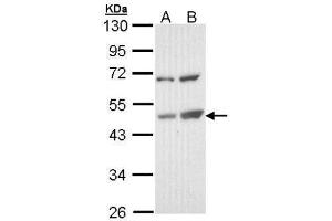 WB Image Sample (30 ug of whole cell lysate) A: Molt-4 , B: Raji 10% SDS PAGE antibody diluted at 1:1000 (TSPYL1 抗体)