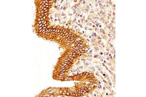 Immunohistochemistry (Paraffin-embedded Sections) (IHC (p)) image for anti-Epithelial Cell Adhesion Molecule (EPCAM) (AA 302-335), (C-Term) antibody (ABIN6242230)