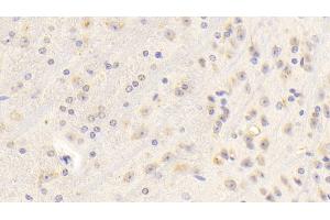 Detection of IGF1 in Mouse Cerebrum Tissue using Polyclonal Antibody to Insulin Like Growth Factor 1 (IGF1)